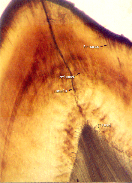 Esmalte dental sob luz refletida 1